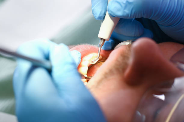 Best Knocked-Out Tooth Emergency  in Miami, AZ