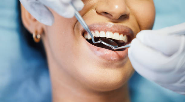 Best Dentist for Tooth Abscess  in Miami, AZ